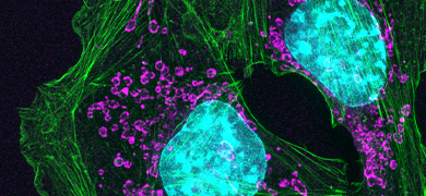 Purple and green top mouse skin cancer cells.