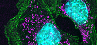 HBSS with 10 mM HEPES, Without Phenol Red