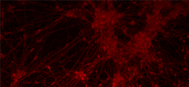 Red neural progenitor stem cells.