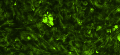 Green Parkinsons cells.