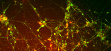 Green and orange dopaminergic neural progenitor cells