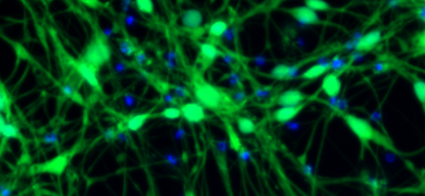 String-like web of fluorescent green and blue organic anion transporter proteins.