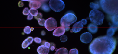 Blue and purple ICC organoid cells.