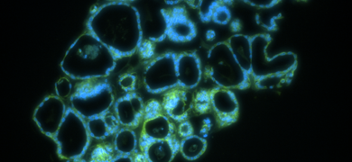 Blue and green ecad488 organoid cells.