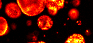 Spherical, red and yellow organoids.