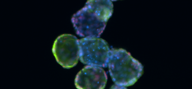 Green and blue 488 ck20 organoid cells.