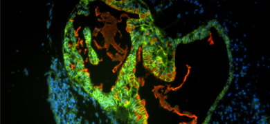 Green, blue and red organoid cells.