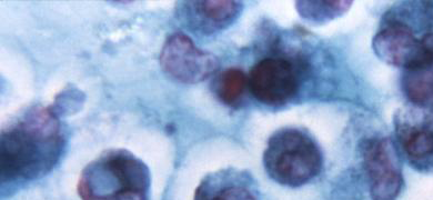 Blue clusters of white blood cells.