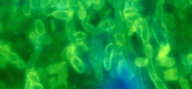 Green, translucent, fluorecent, rod-shaped Candida albicans fungus.