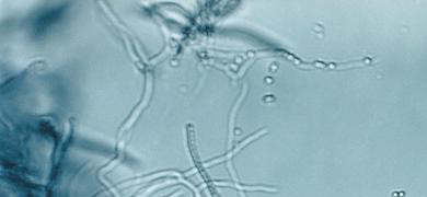 Translucent, blue strands of streptomyces bacteria.