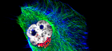 Normal rat kideny cells NRK-49f.