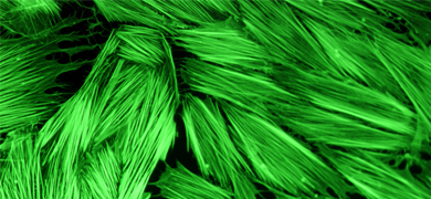 Green human colon fibroblasts.