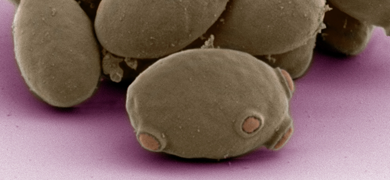 Purple saccharomyces cerevisiae yeast.