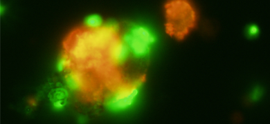 Green and orange HEp2 cells infected with EAEC.