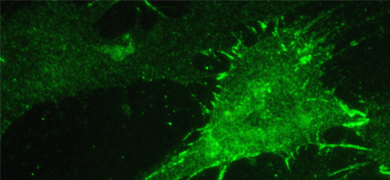 Green loose cadherin adhesions in cultured melanoma cells.