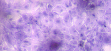 Purple VR-734 cells.