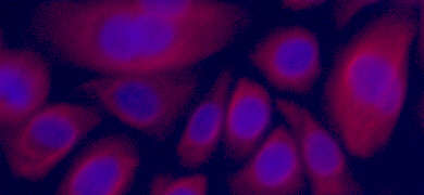 Red and blue vaginal epithelial cells.