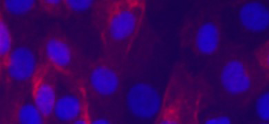 Blurry, fluorescent purple renal proximal tubular epithelial cells.