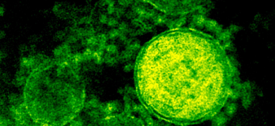 Green MERS CoV cells.