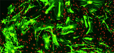Green and red astrocyte GFAP cells.