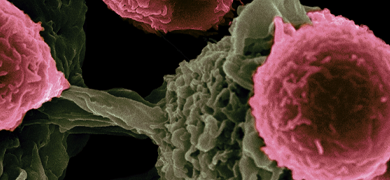 Gray green and pink bunch of dendric T-cells.