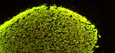 Neural progenitor cell derived neurosphere