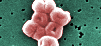 Blurry donut-shaped, pink Acinetobacter baumannii bacteria.
