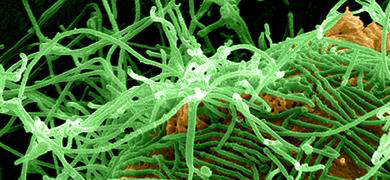 Tangled ball of long green and yellow ebola virus tendrils.