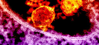 Grainy, red-orange and purple spheres of Middle East respiratory syndrome coronavirus.