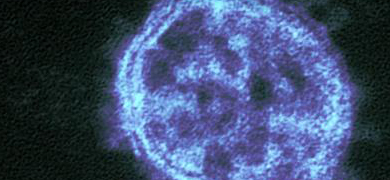 Grainy, blue and black translucent spheres of Middle East respiratory syndrome coronavirus.