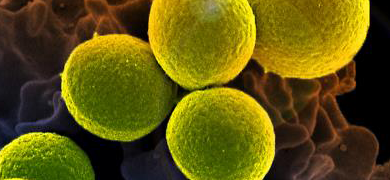 Cluster of floating green, yellow and orange Methicillin-resistant Staphylococcus aureus spheres.