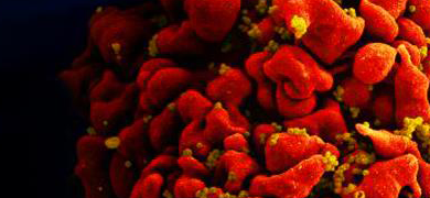 Red and gold HIV-infected-H9-T-cell.