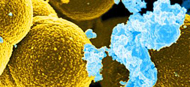 Gold and blue Staphylococcus aureus bacteria spheres and clusters.
