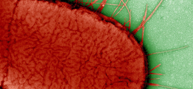 Closeup of  red Escherichia coli bacteria.
