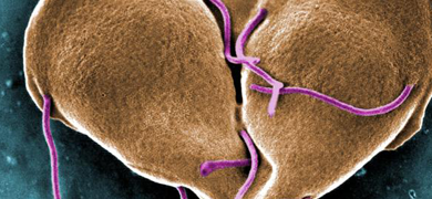 Brown, heart-shaped  Giardia parasite with pin tendrils.