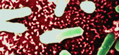 Thin, green rods of Clostridium difficile bacteria.