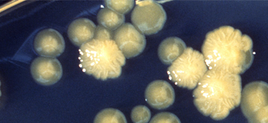 Yellow, translucent Enterobacter cloacae gut bacteria including some with thread-like bursts inside.