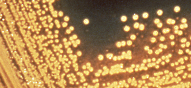 Tiny, yellow beads of Vibrio cholerae bacteria strung together with some spaces in between.
