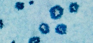 Grainy, dark blue smudges of influenza virus on a light blue background.