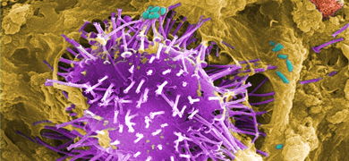 Purple bacteria covered in white protruding stalks.