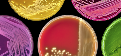 Petri dishes filled with bright-colored cells and media in different line and spot patterns.