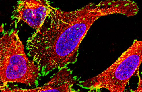 Red, purple, green, and yellow A549 CRISPR cells.