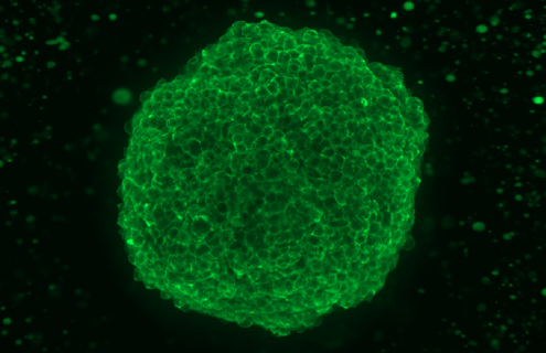 A bright-green, fluorescent, EGFR stain sphere with a black background.