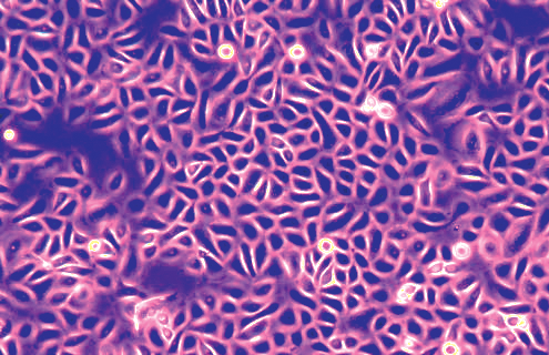 Cluster of small, fluorescent pink and black primary keratinocyte cells.