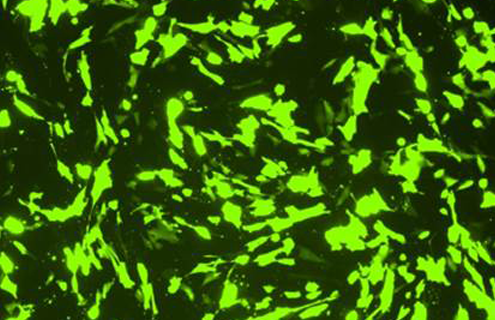 Fluorescent lime-green primary bladder cells.