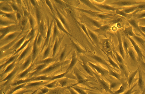 Gold and black fibroblast cells.