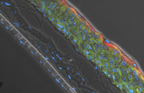 Ker-ct filiggrin epithelial cells.