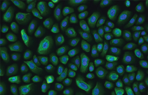 Green and blue NuLi lung epithelial small airway cells.