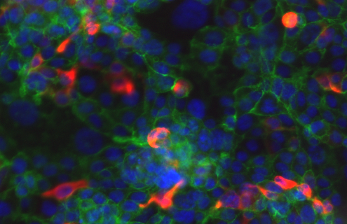 Fluorescent blue, red, and green colon cells.