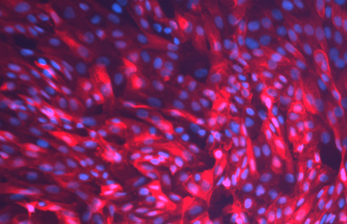 Blue and pink hTER renal proximal tubular epithelial cells.